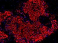 stem cells from jaw bone